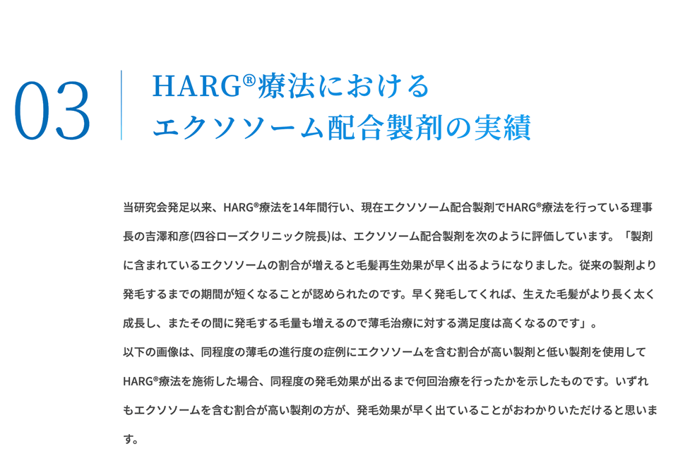 HARG ® 療法におけるエクソソーム配合製剤の実績
