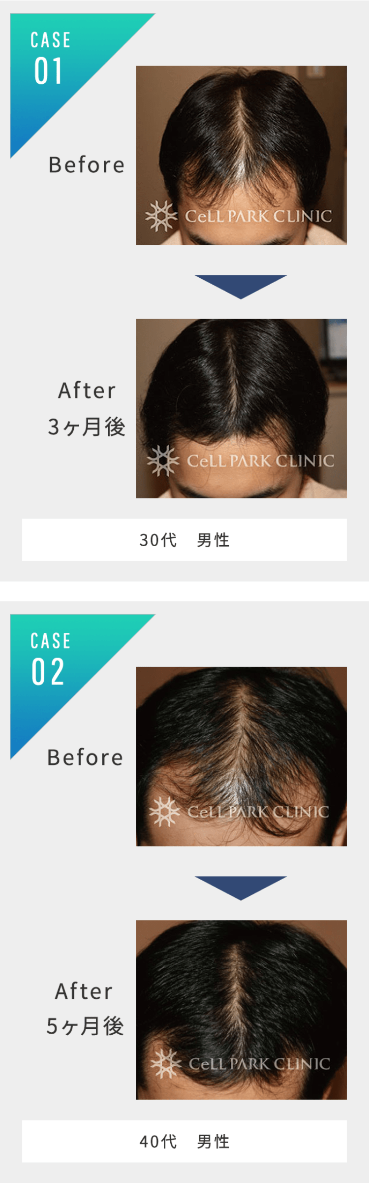 医療毛髪再生harg 薄毛でお悩みの女性にも 診療内容 医療脱毛 スキンケアなら渋谷の美容皮膚科渋谷皮フ科医院